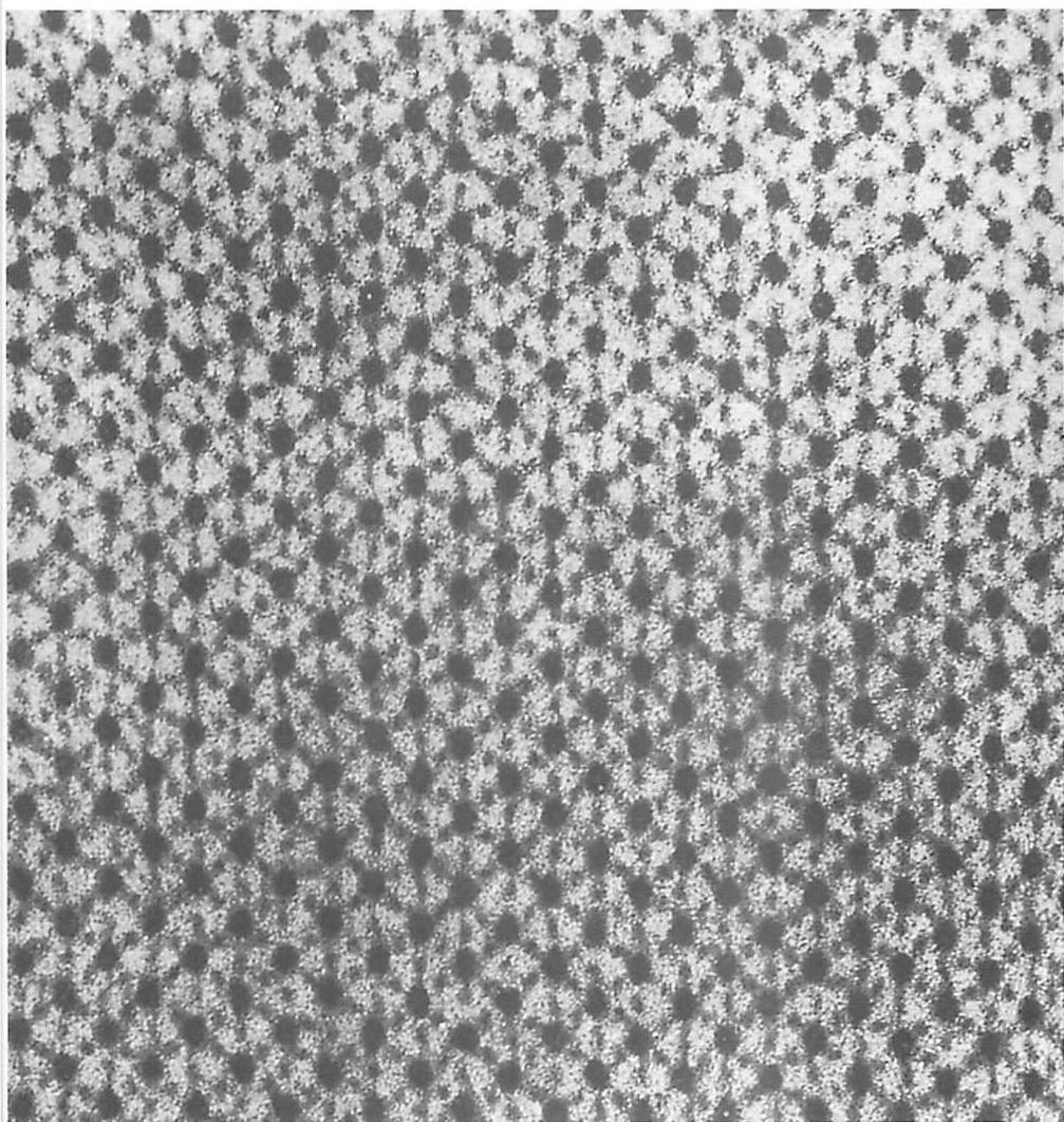 Electron micrograph of muscle fiber