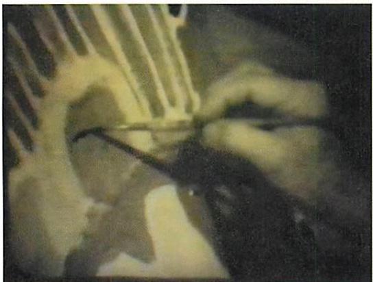 Step 3 in the process