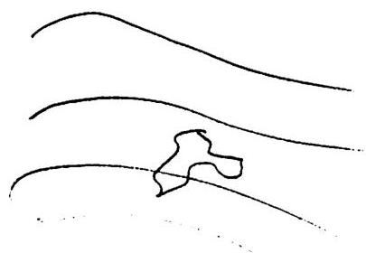 Effect of an asymmetric structure on the land: Not harmonious